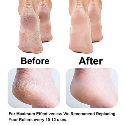 Electric Callus Remover for feet Rechargeable Pedicure Tool for Dead Skin, Foot Roller Callus Remover Hard and Dead Skin Remover